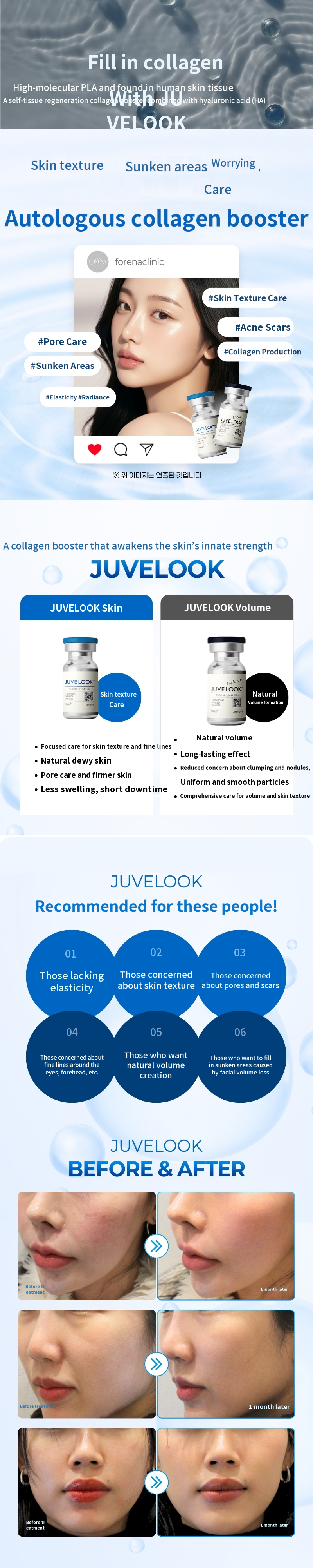 [Hongdae Forena Clinic] Juvelook Skin/Volume