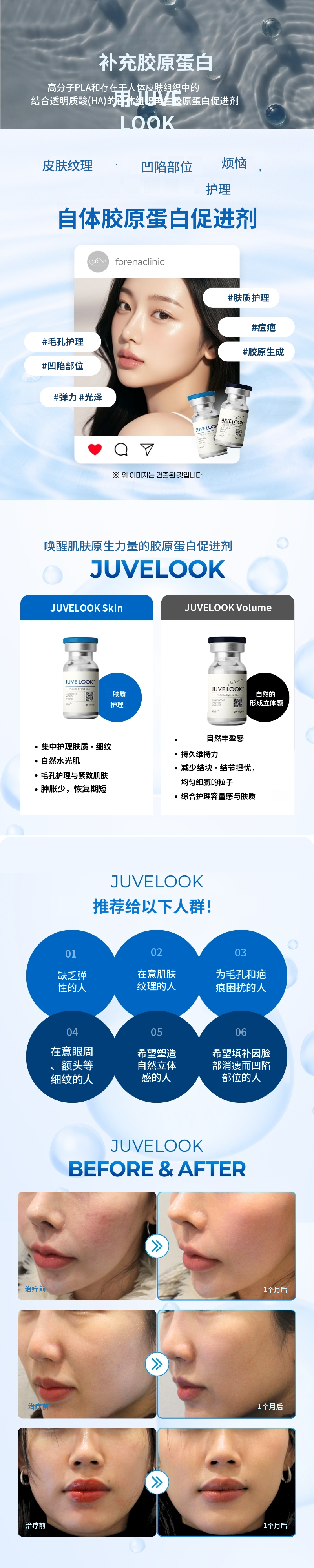 [弘大Foreina医院] Juveelooks皮肤/体积