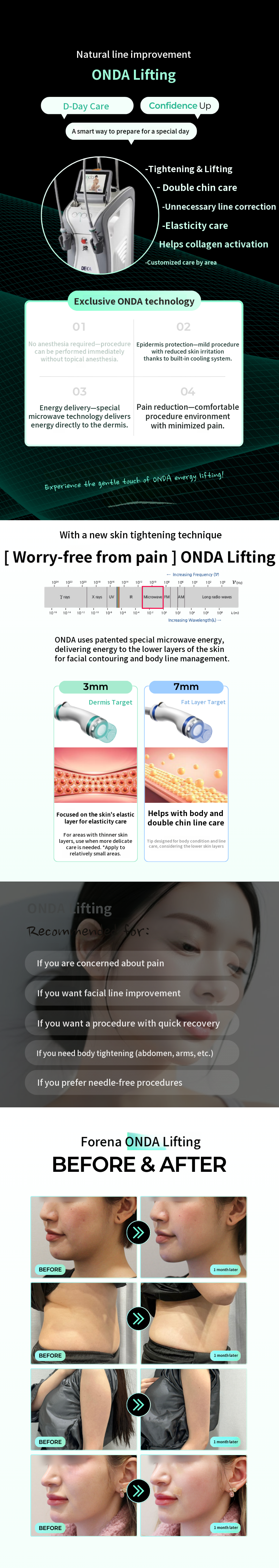 [Hongdae Forena Clinic] Onda Lifting
