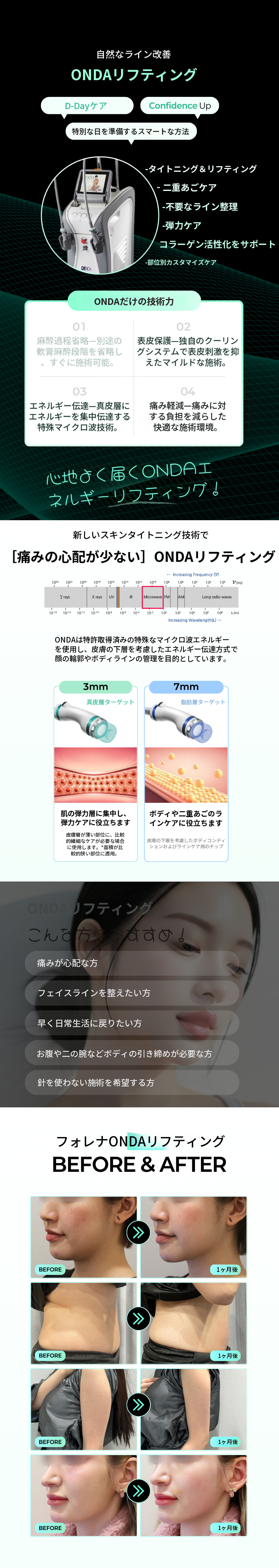 [홍대 포레나の医院] オンダリフティング