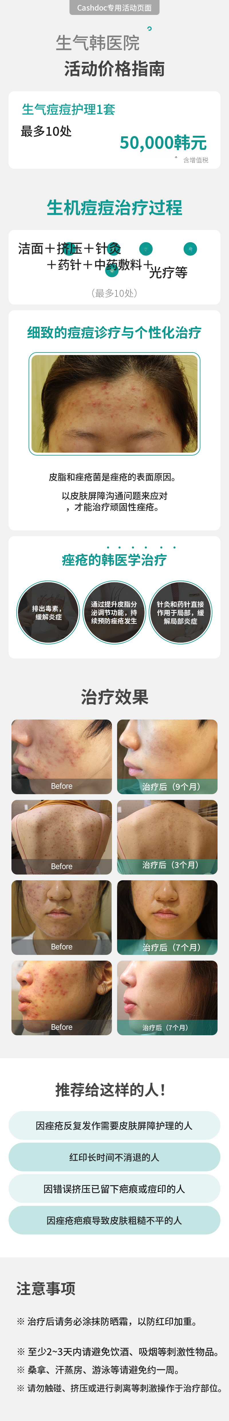 青春痘护理套装 1