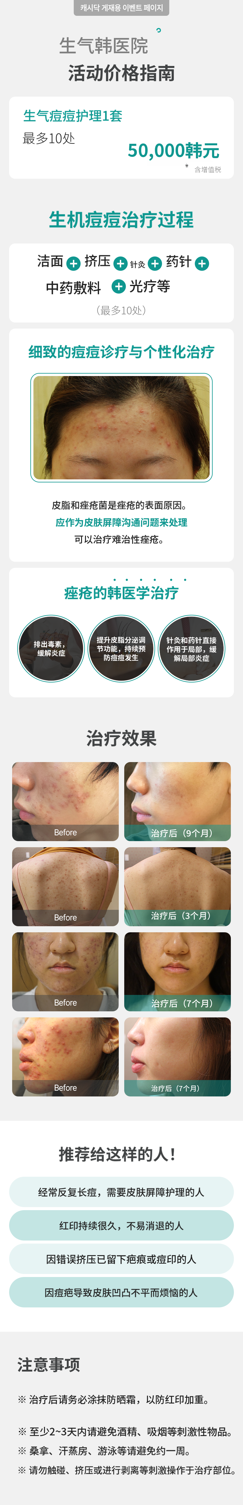 青春痘护理套装 1