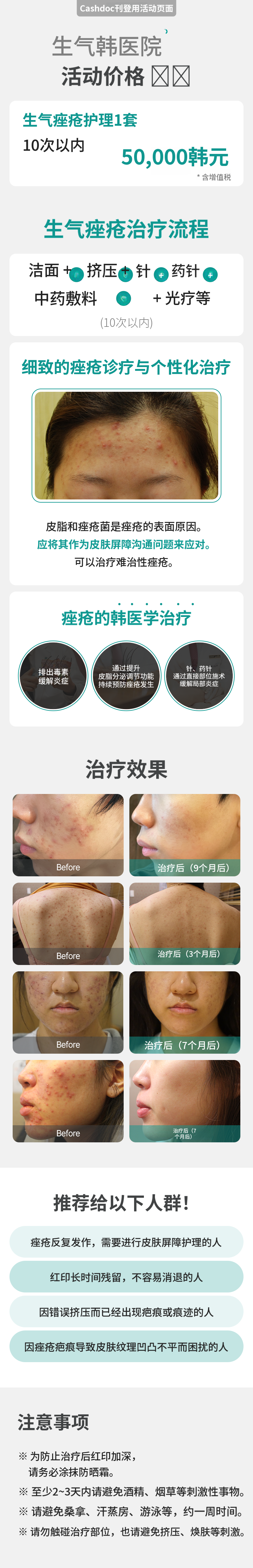 焕活痤疮护理1套