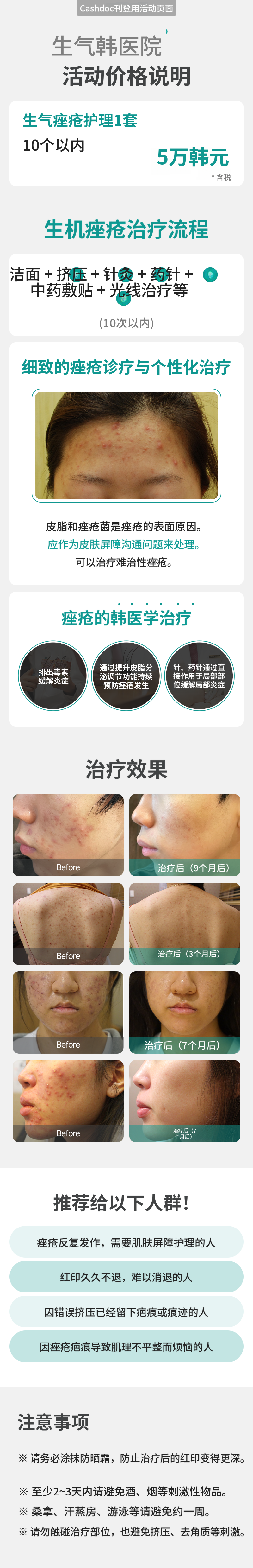 焕活痤疮护理1套