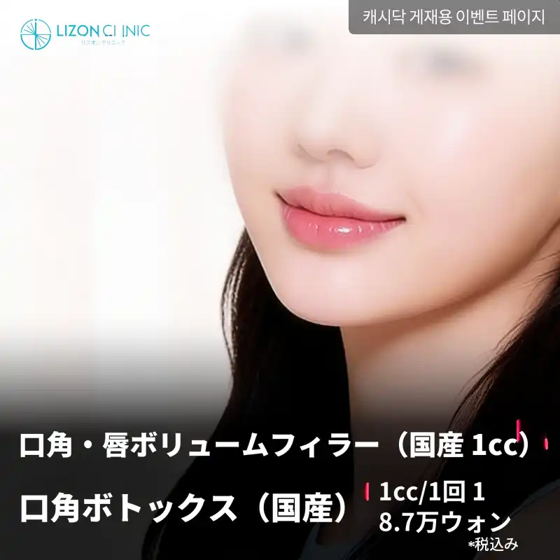 リズオン水原_口角、唇ボリュームフィラー