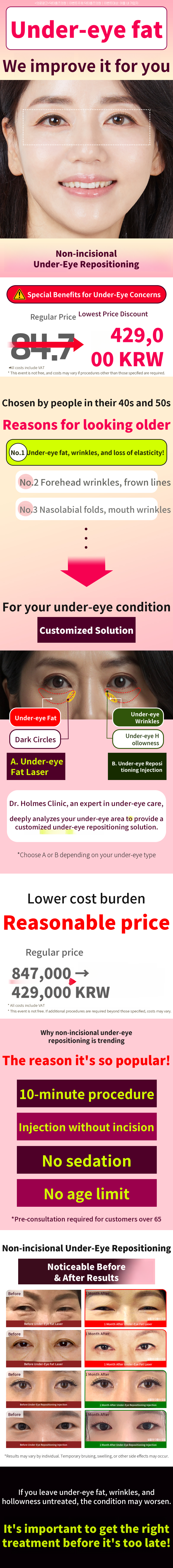 Non-Invasive Under-Eye Fat Relocation