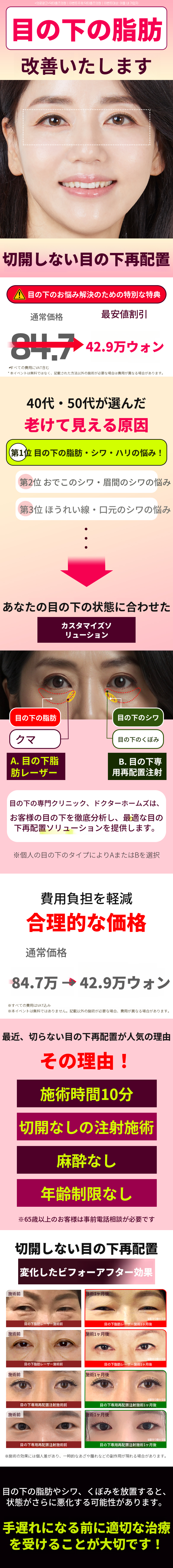 非切開下まぶた脂肪再配置