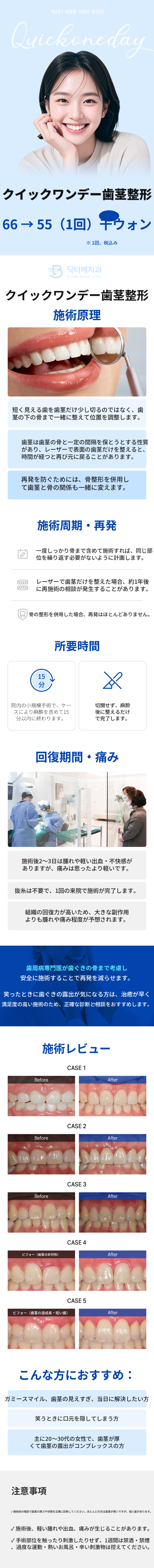 クイックワンデー歯茎形成