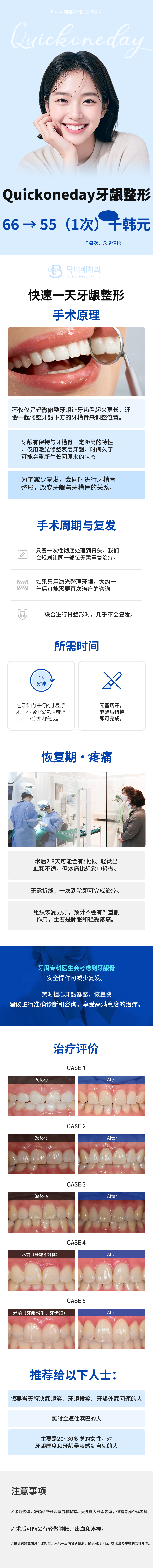 快速一日牙龈整形