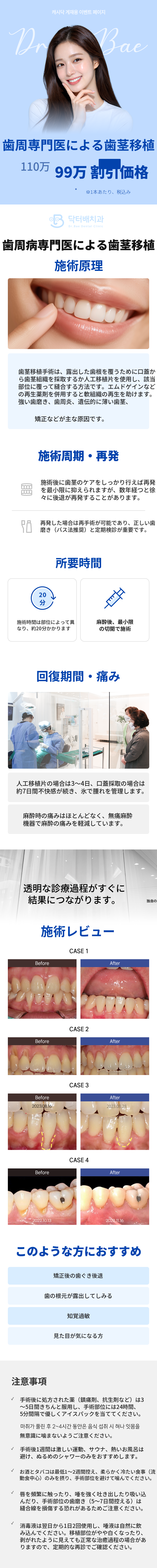 歯周病専門医 歯茎移植