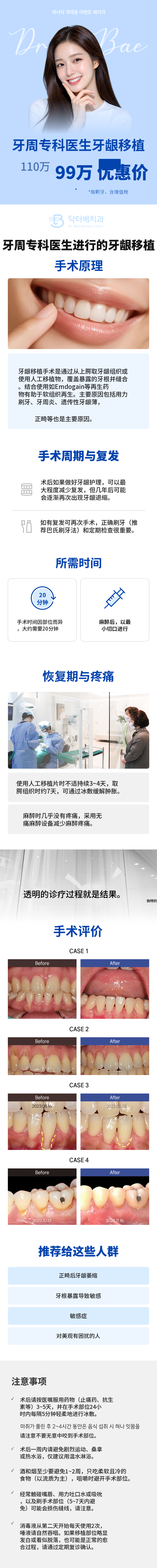 牙周病专科医生牙龈移植