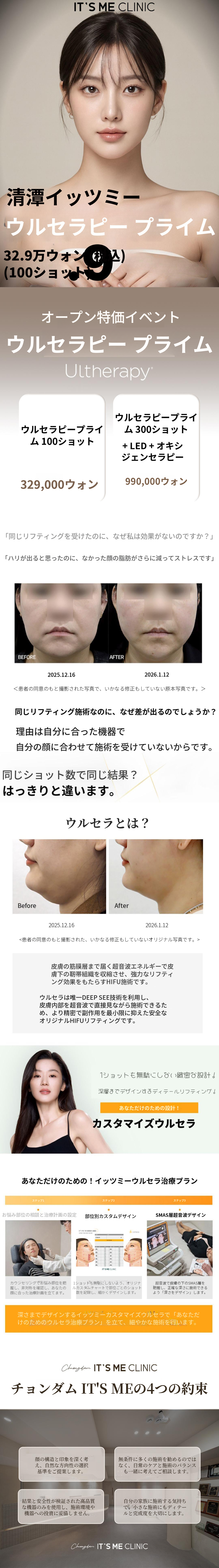 ウルセラピプライム オープン特価