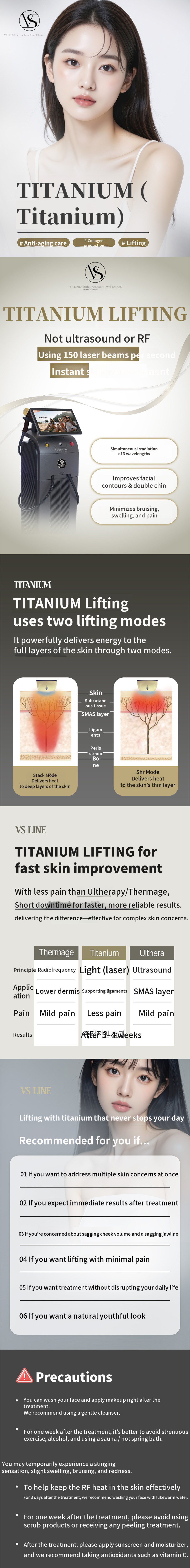 Incheon Titanium Lifting 40KJ