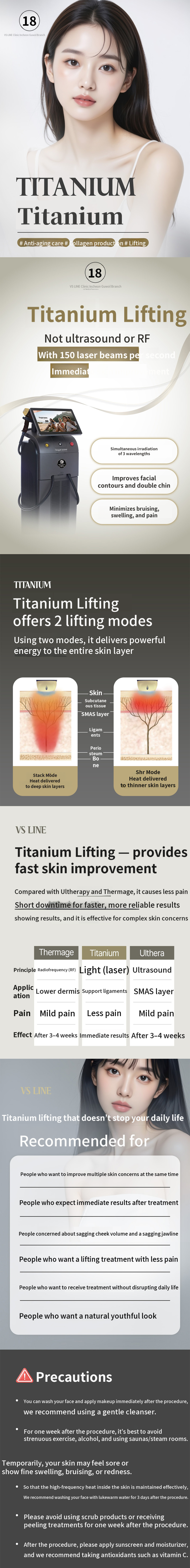 Incheon Titanium Lifting 60KJ