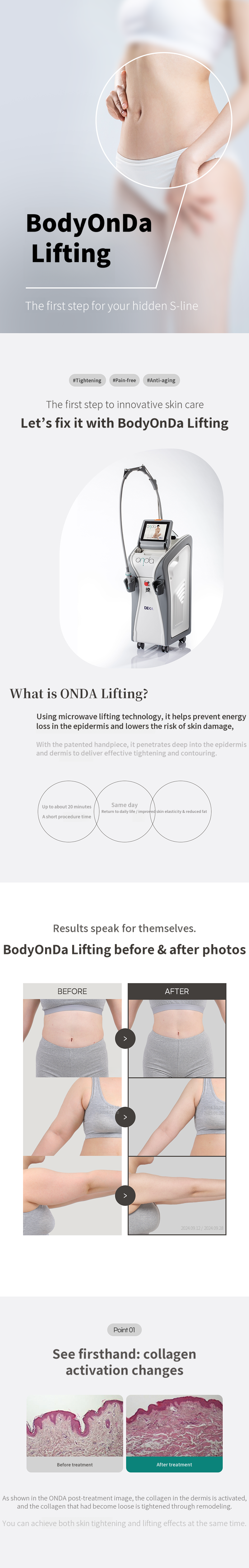 Body Onda Lifting 80KJ 1 session