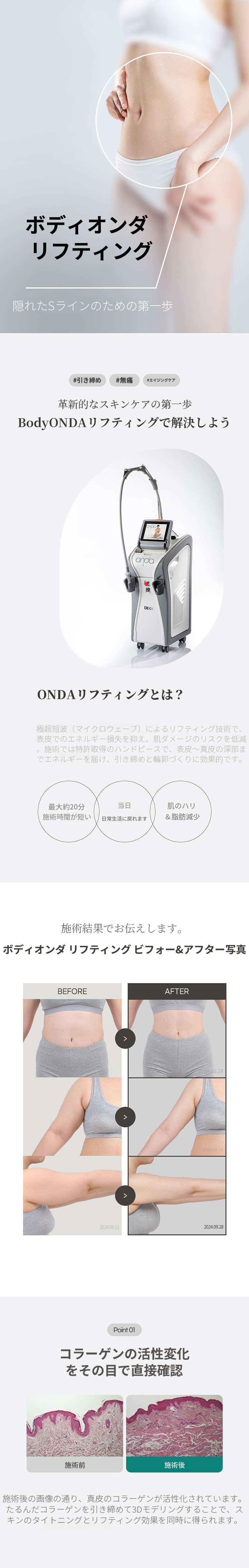 ボディオンダリフティング 200KJ 1回