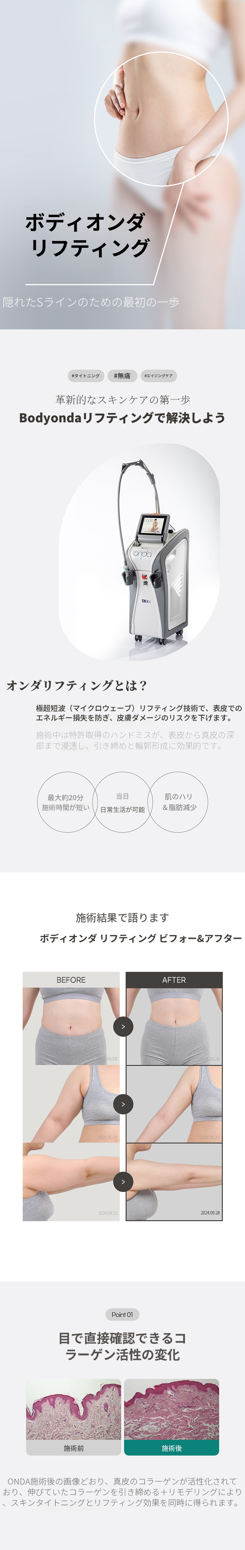バディオンダリフティング 200KJ 3回