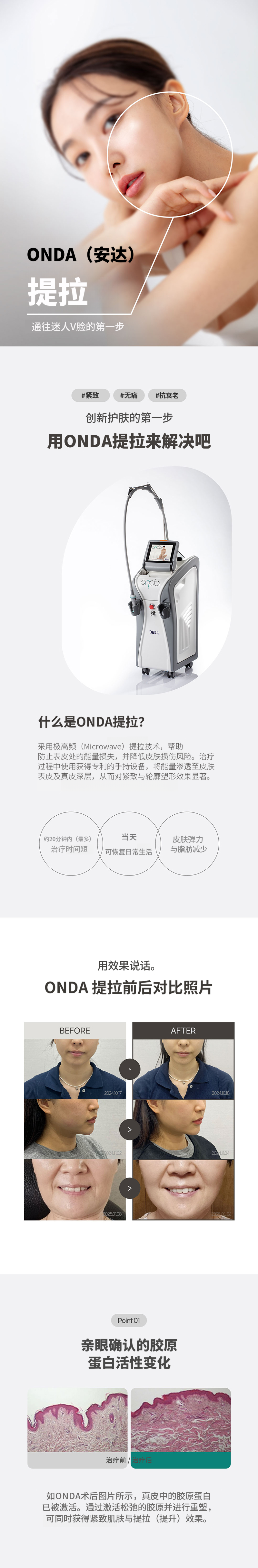 温达提拉夫丁 80KJ