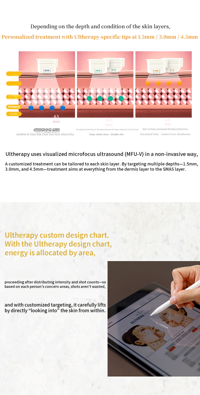 Ultherapy Prime 100 Shots First Visit Event