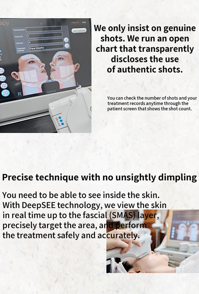 Ultherapy Prime 100 Shots First Visit Event