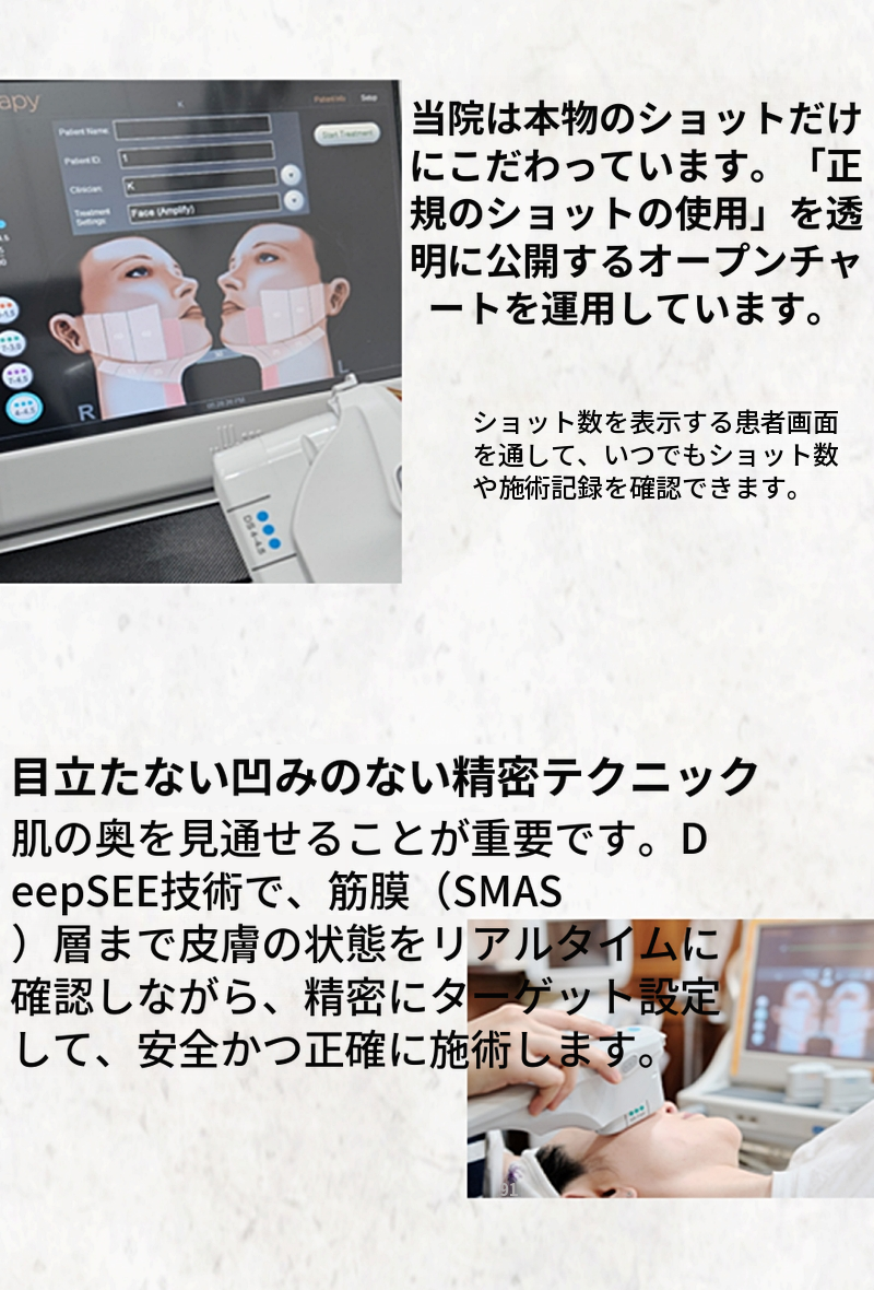 ウルセラピー プライム 100ショット 初回訪問イベント