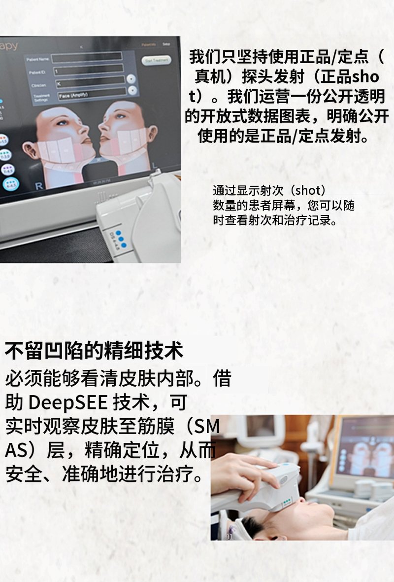 Ultherapy Prime 100针首访活动