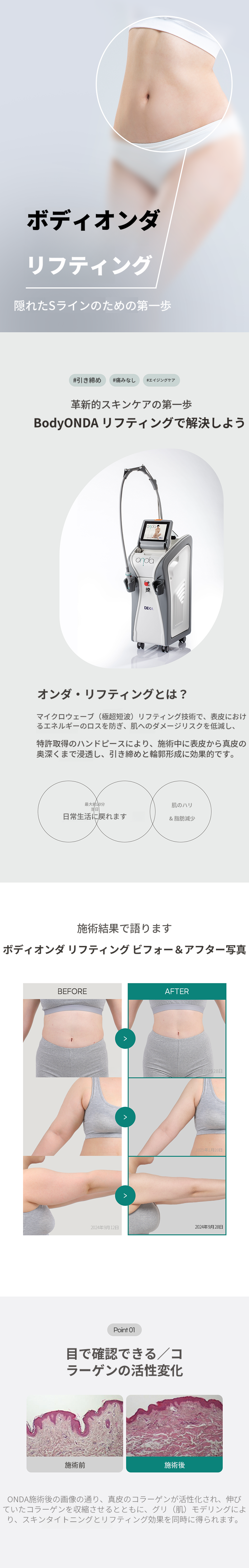 ボディオンダリフティング 80KJ