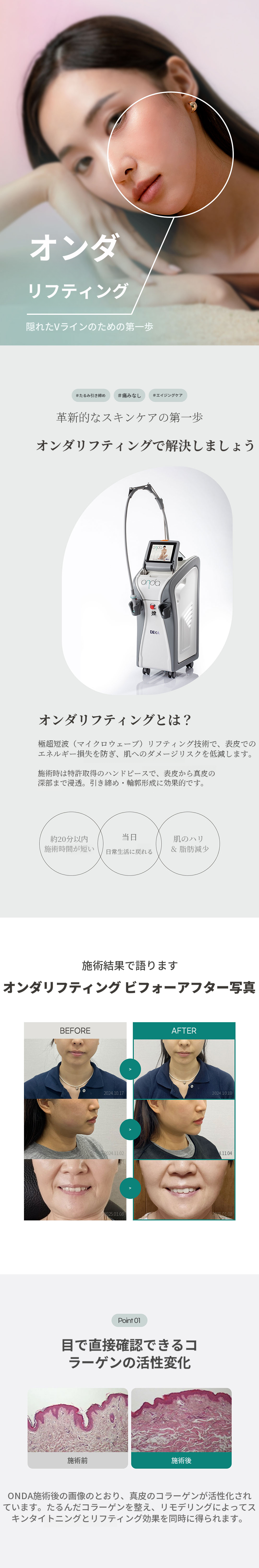 オンダリフティング 60KJ