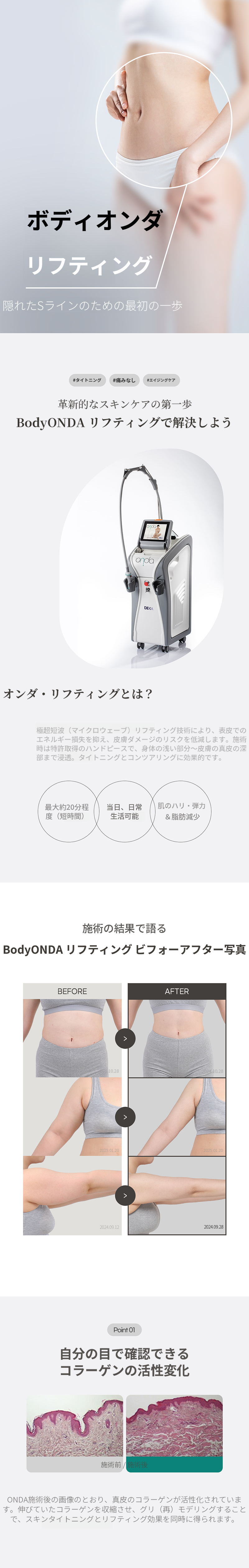 ボディオンディリフティング 40KJ