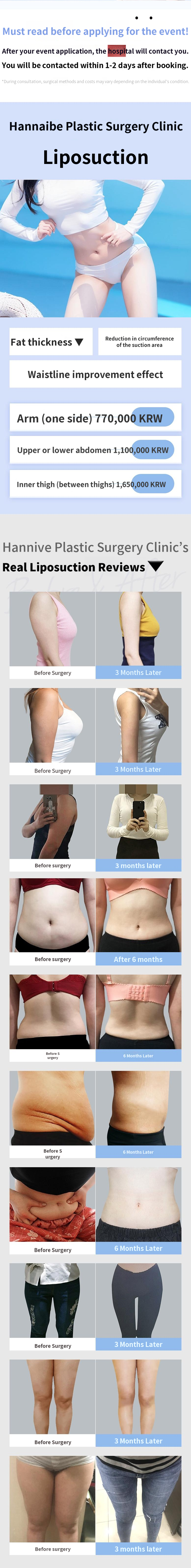 Large Capacity Handmade Body Liposuction