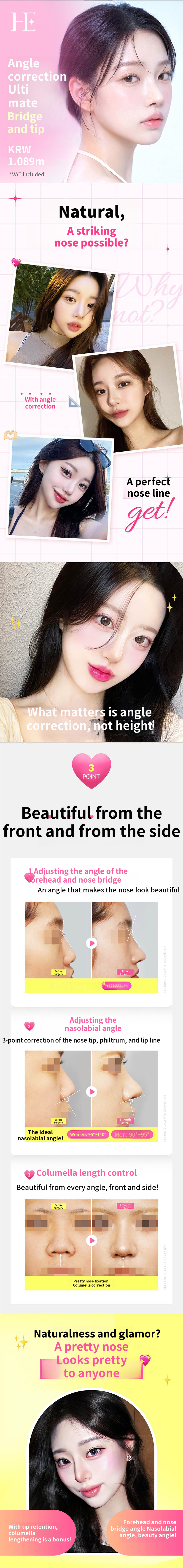Customized Nose Tip Surgery for Higher Nose Bridge