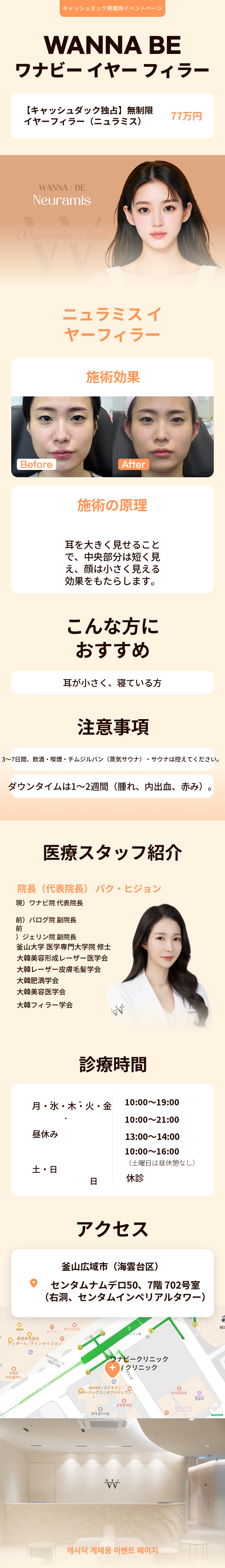 耳のフィラー無制限/ニュラミス