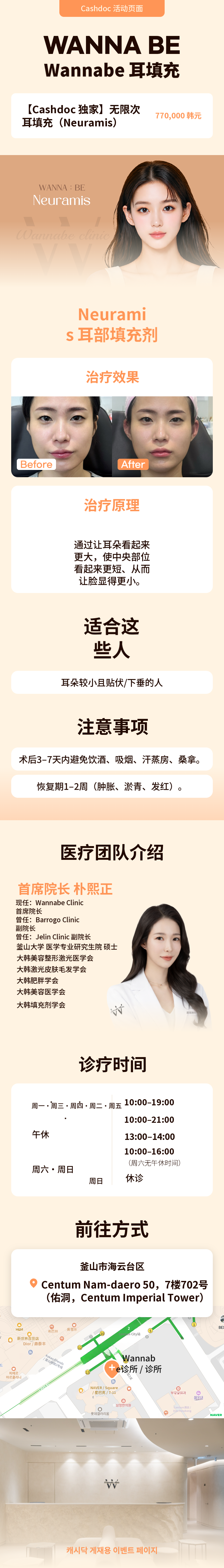 耳填充物无上限/新拉美斯