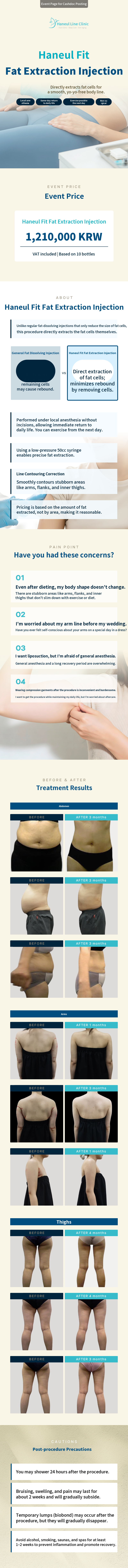 Sky Fit Fat Extraction Injection