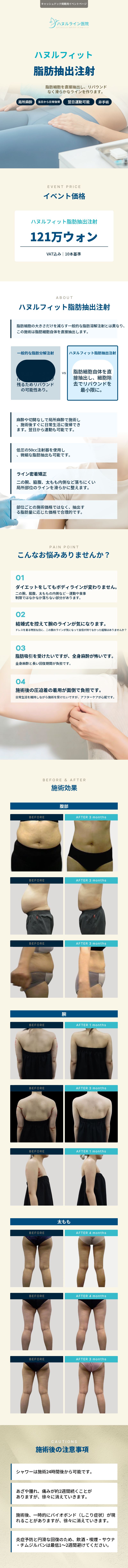 ハヌルフィット脂肪抽出注射