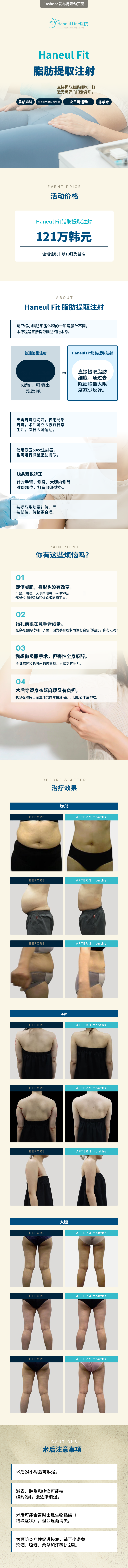 哈尼尔脂肪抽取注射
