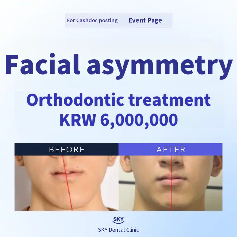 Facial Asymmetry Correction