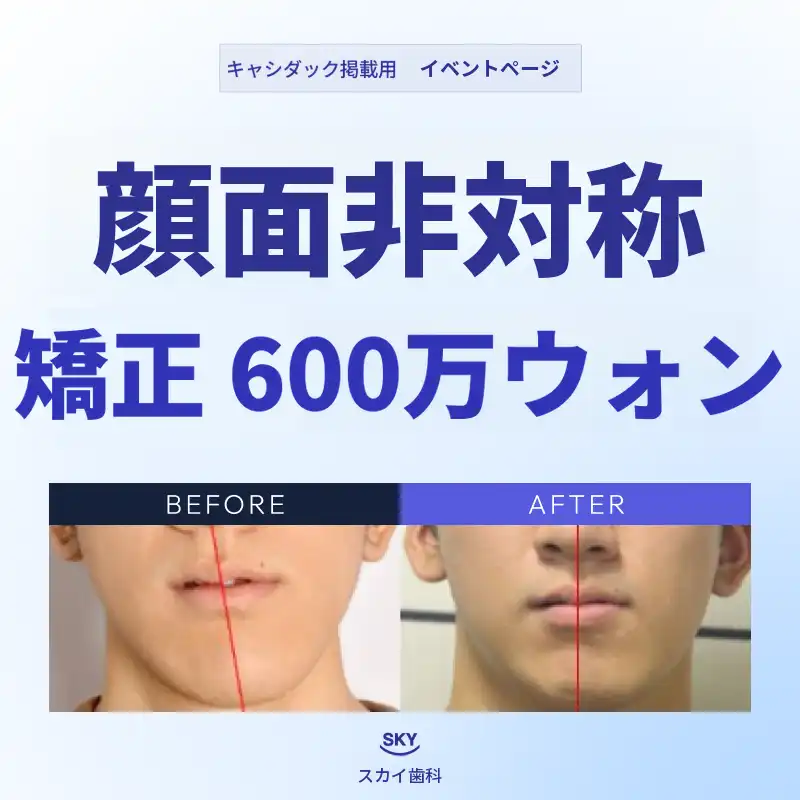 顔の非対称修正