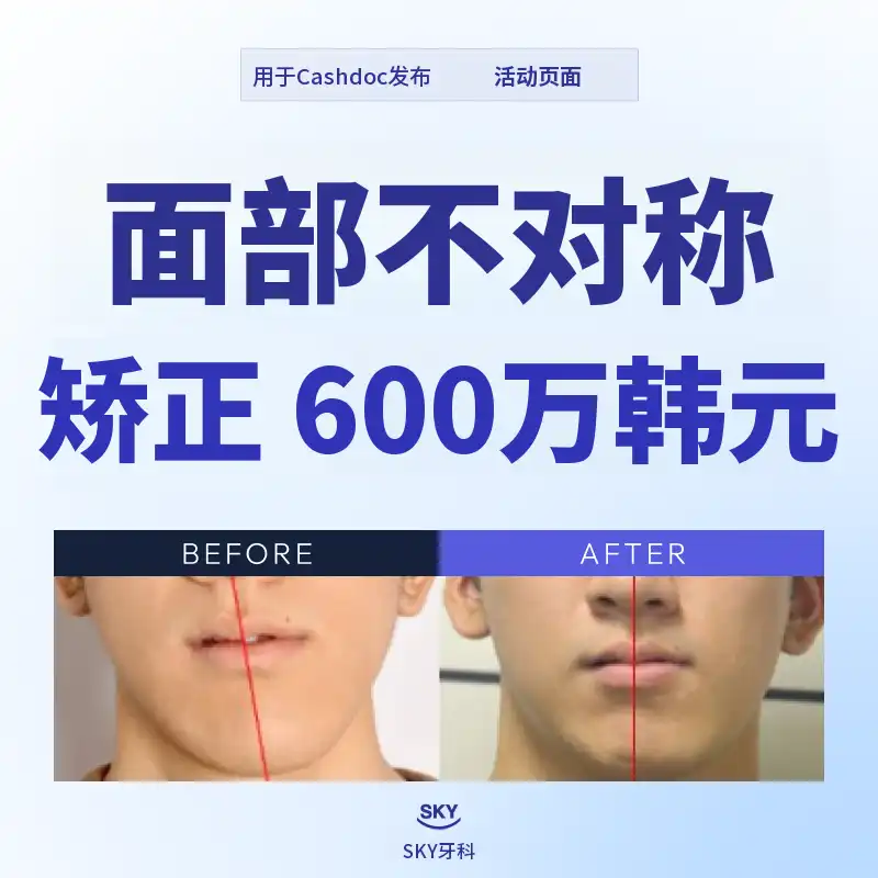 面部不对称矫正