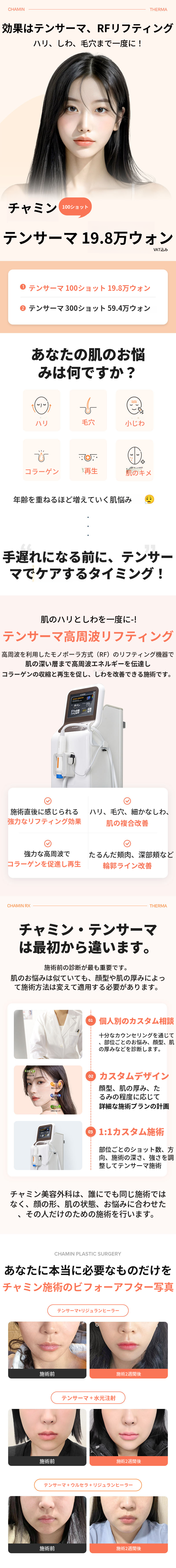 チャミンテンソーマリフト