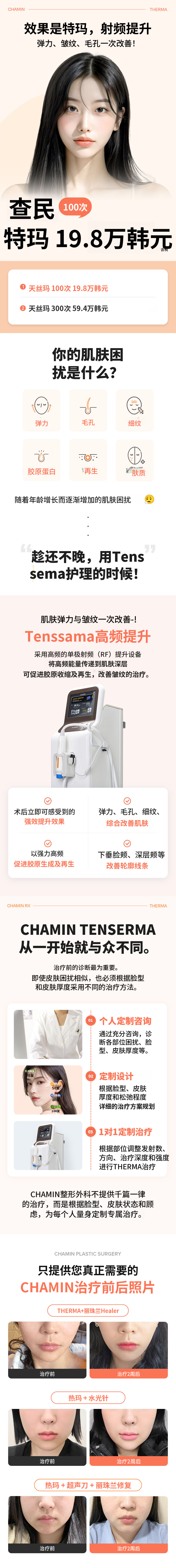 车敏提拉玛丽提升