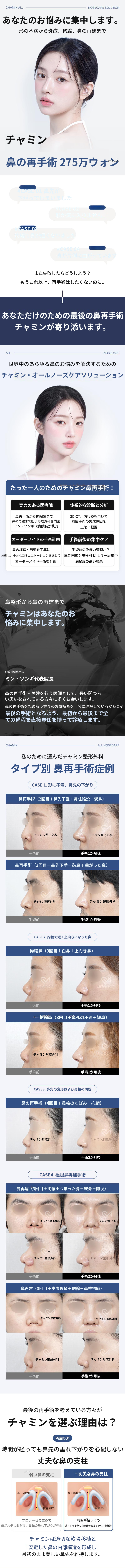 チャ・ミン 鼻整形 275