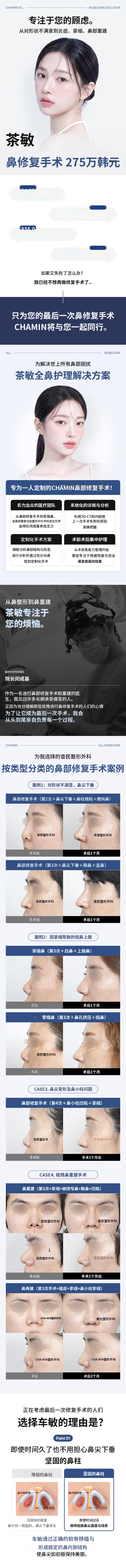 车敏鼻整形手术 275