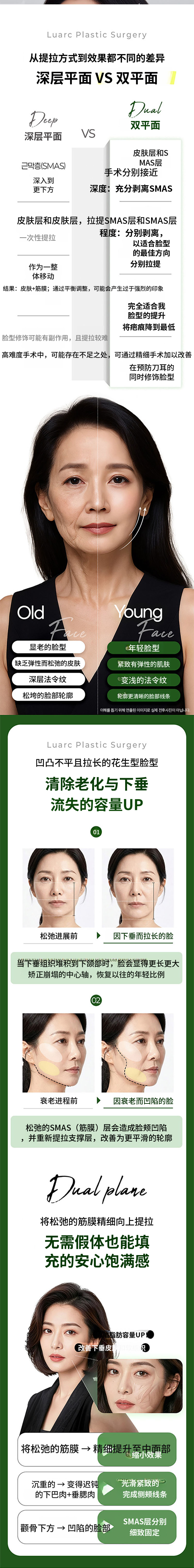 鲁阿克 SMAS 双平面全脸提升