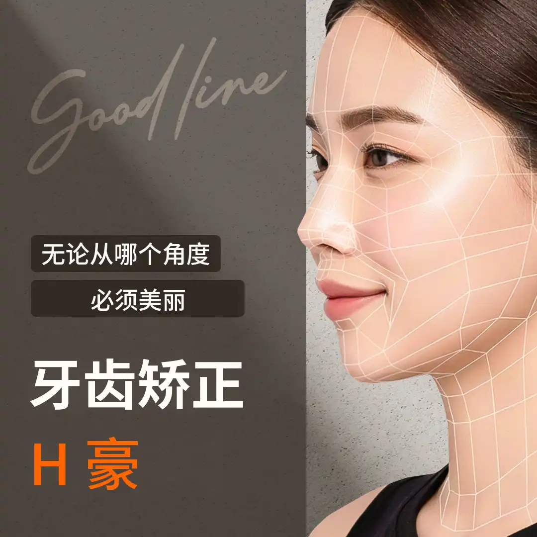 为我量身定制的Good-line牙齿矫正