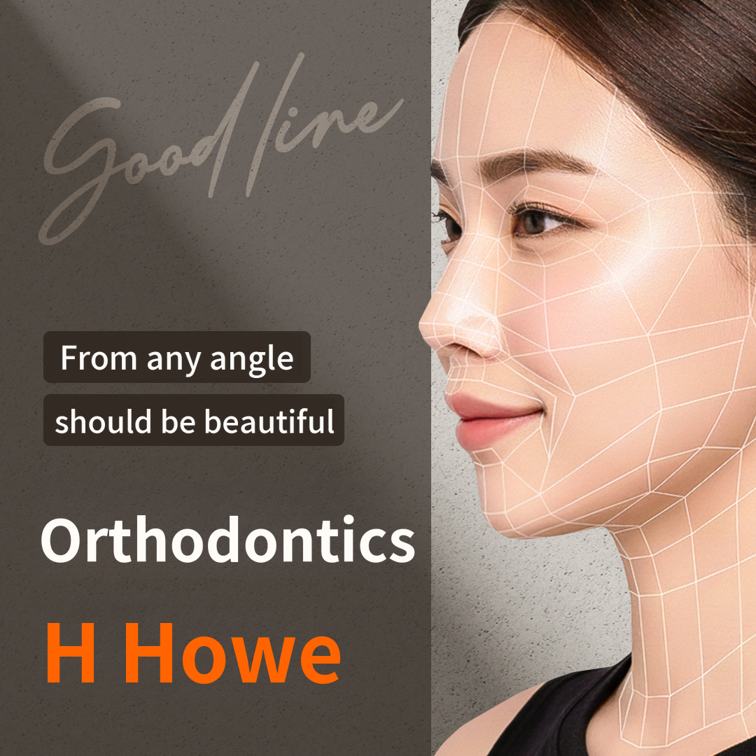 Customized Good-line Teeth Alignment Just for You