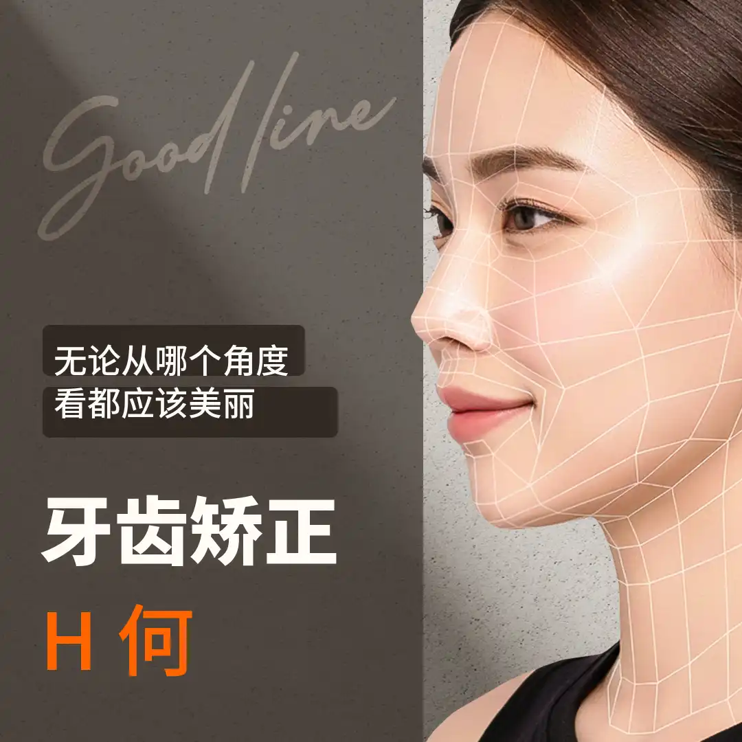 为我量身定制的Good-line牙齿矫正