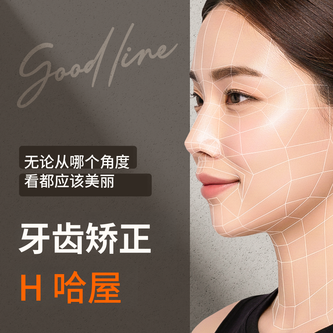 专为我设计的Good-line牙齿矫正