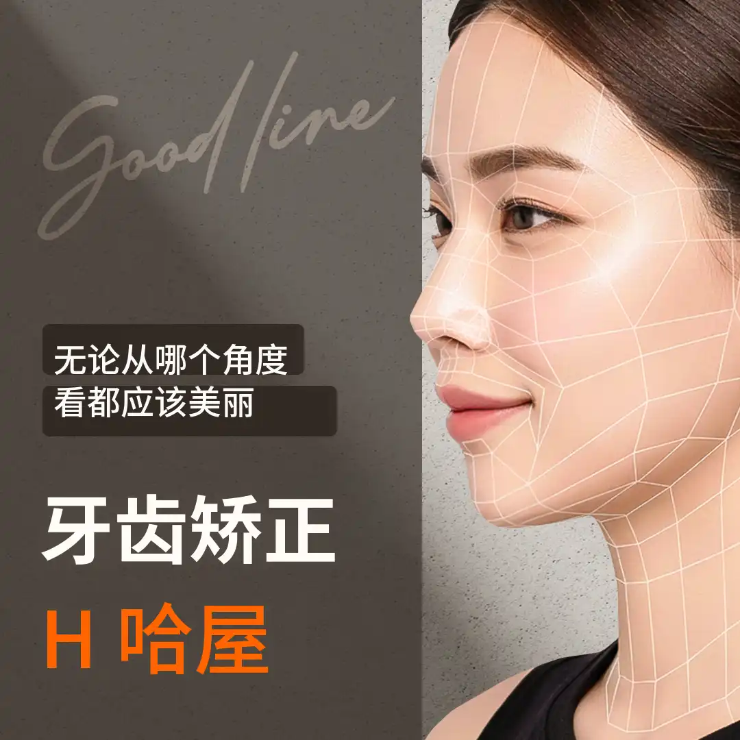 专为我设计的Good-line牙齿矫正