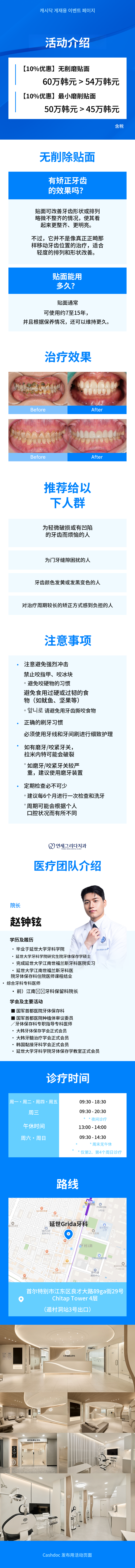 无雕刻贴面